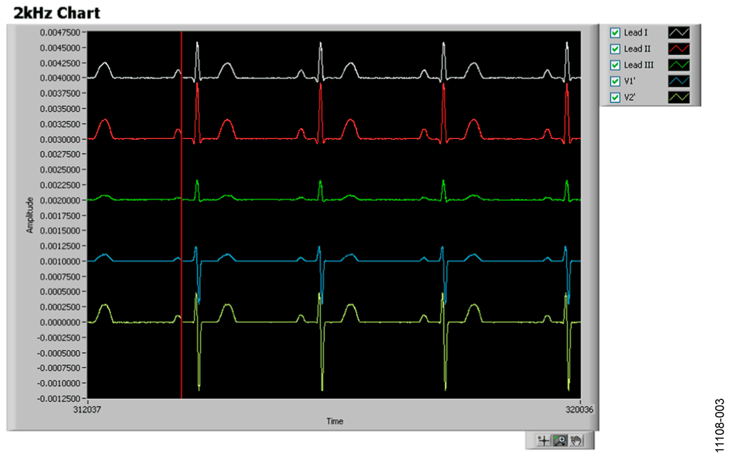 ADAS100 ECG Chart